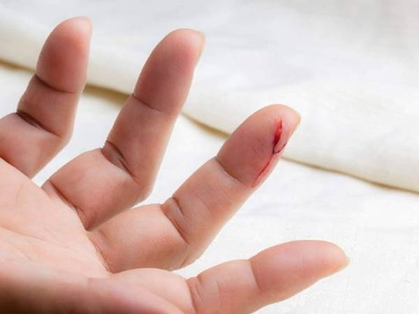 Trong giấc chi&ecirc;m bao thấy người th&acirc;n bị đứt tay chảy m&aacute;u